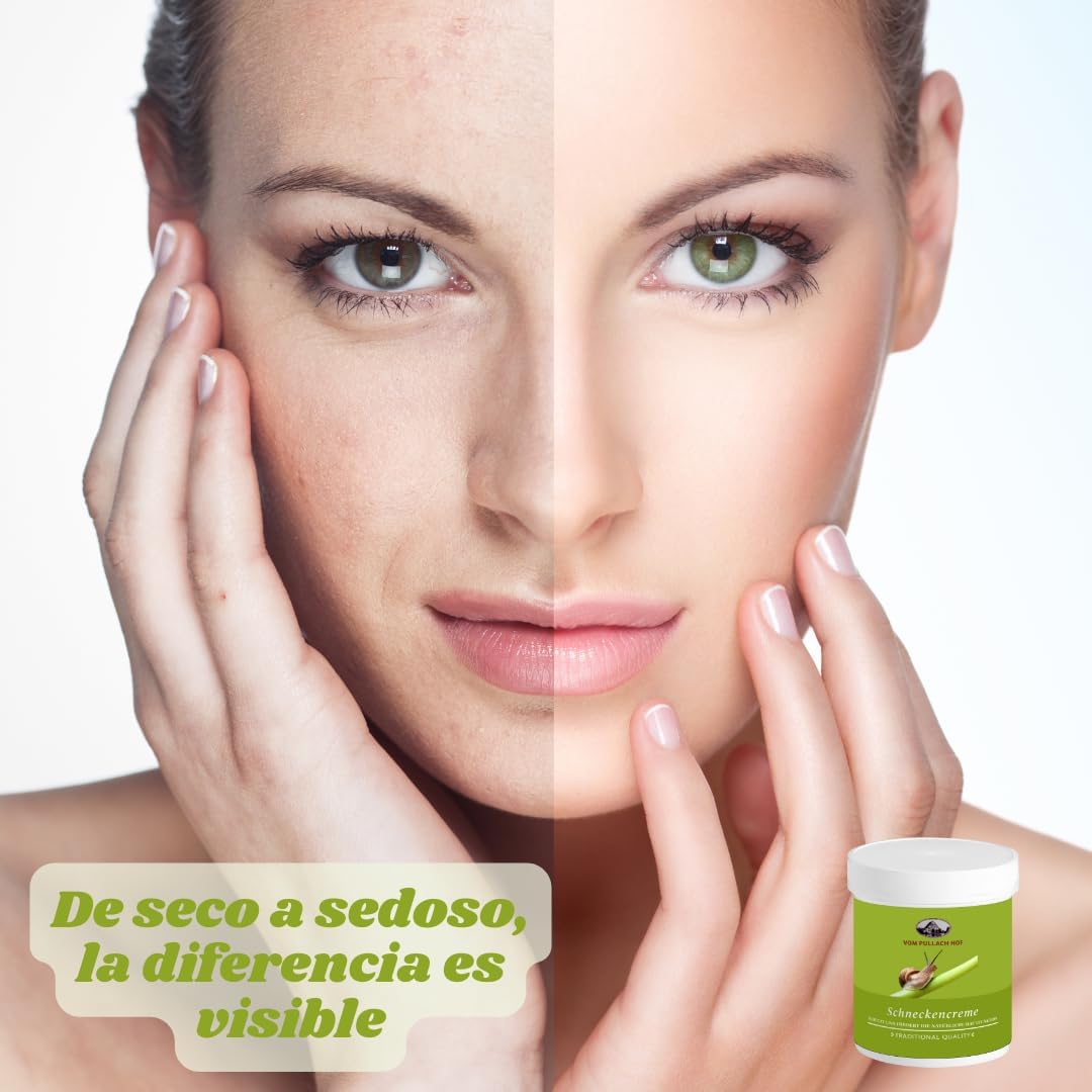 Crema Baba de Caracol - Hidratante Corporal - Aclaradora de Manchas - 150 ml
